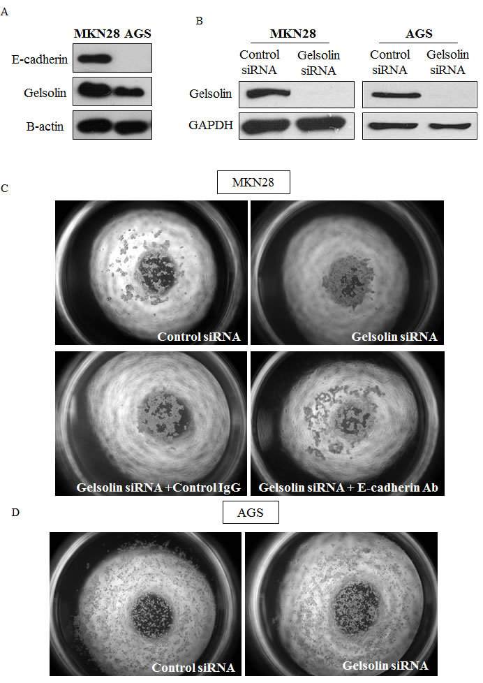Loss of Gelsolin promotes E-cadherin-dependent intercellular adhesion of gastric cancer cells.