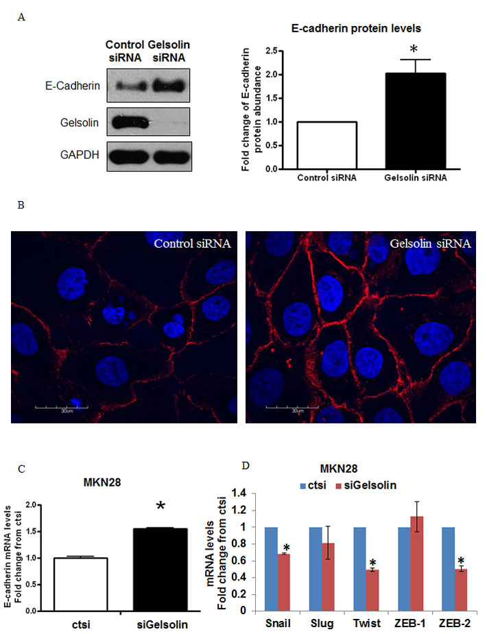 Loss of Gelsolin increases E-Cadherin expression in gastric cancer cells.