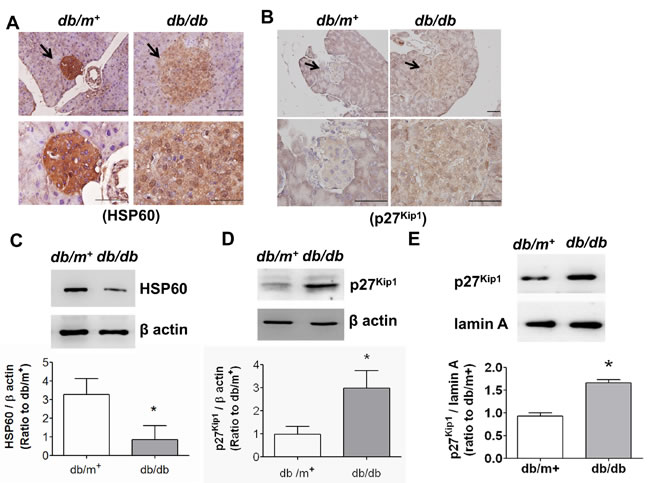 The expressions of HSP60 and p27Kip1 in pancreatic islets of db/db diabetic mice.