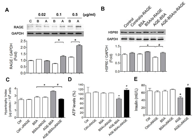 Involvement of AGEs-RAGE axis in the alterations of HSP60 protein expression, cell hypertrophy, ATP production, and insulin secretion in AGEs-treated &#x3b2;-cells.