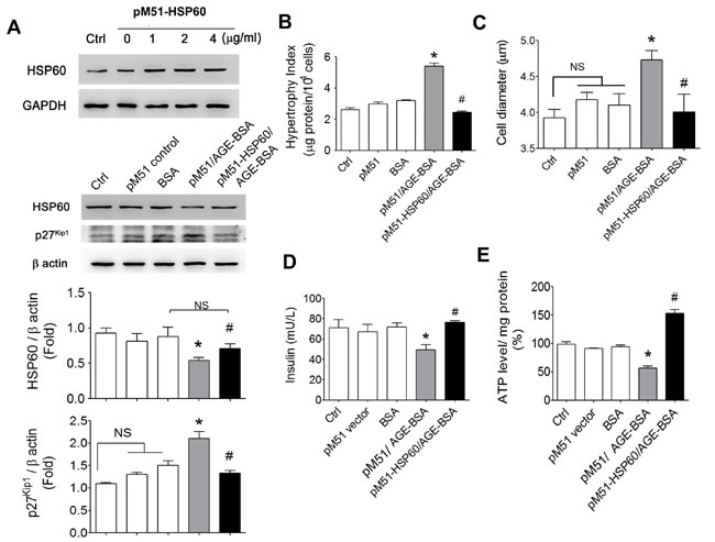 Effects of overexpressed HSP60 on cell hypertrophy and insulin secretion and ATP production in AGEs-treated &#x3b2;-cells.