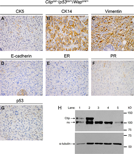 The phenotype of Ctip/p53-deficient mammary carcinomas.