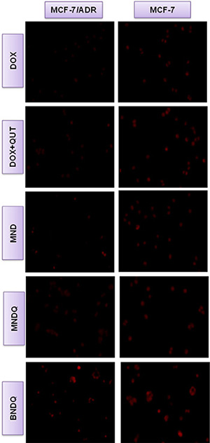 Fluorescent microscopy observations of MCF-7/ADR and MCF-7 cells after incubation with free DOX, DOX + QUT, MND, MNDQ and BNDQ for 4 h.