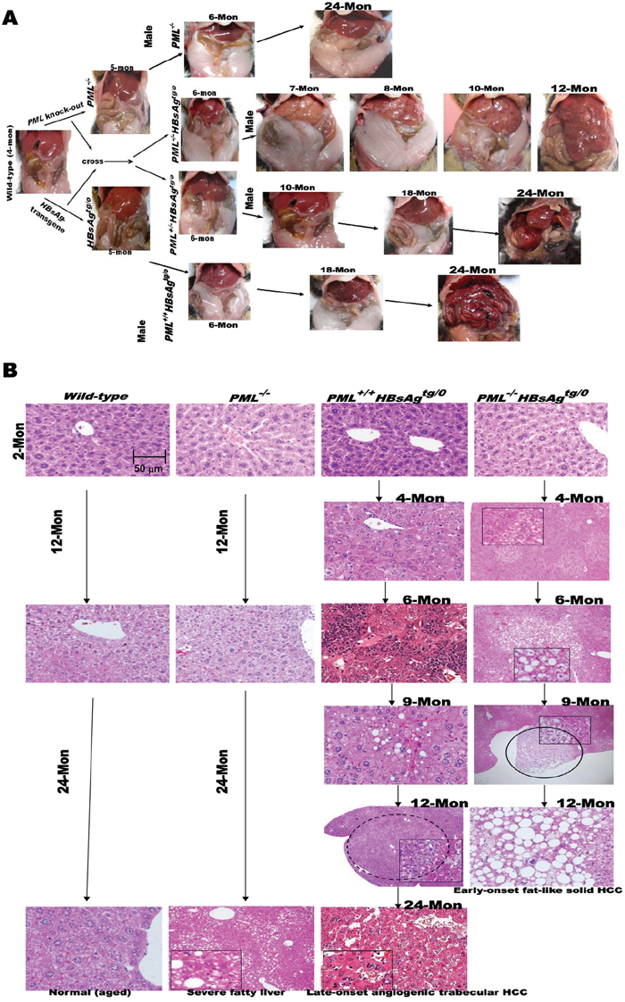 Phenotypes and pathogenesis of liver-specific HBsAg-transgenic mice with or without PML deletion.