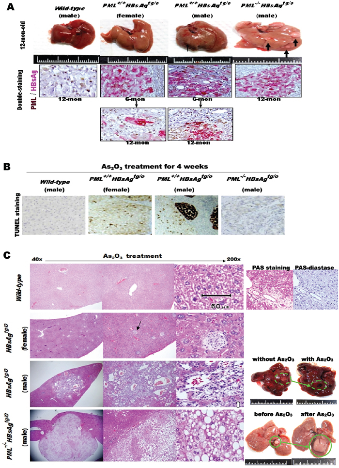 Effects of As2O3 on liver cell death in HBsAg-transgenic mice, with or without PML deletion.