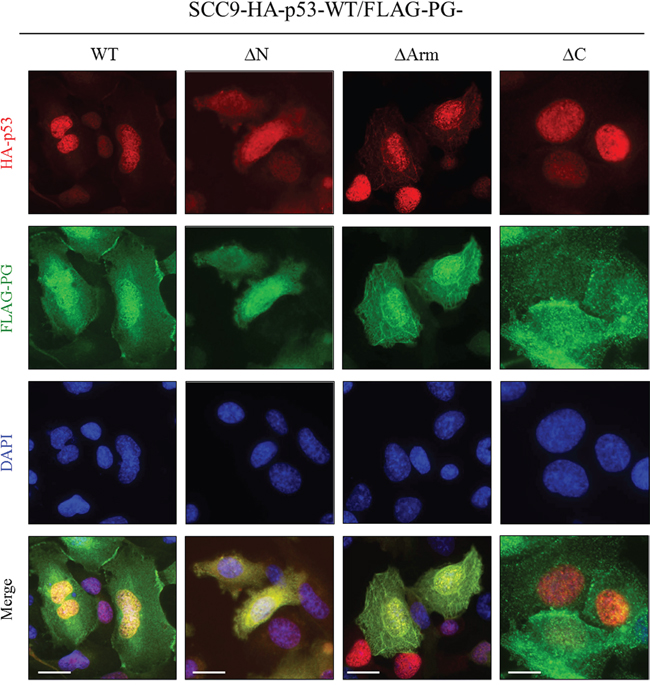 Subcellular localization of PG and p53 in SCC9 double transfectants coexpressing HA-p53-WT and FLAG-PG-WT, -&#x0394;N, -&#x0394;Arm or -&#x0394;C.