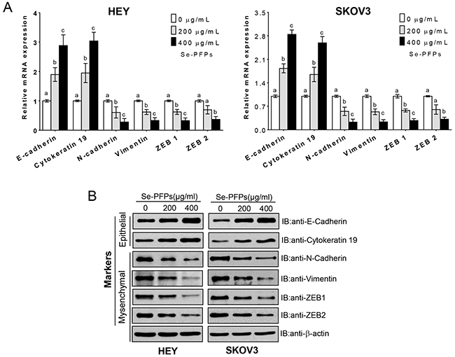 Se-PFPs treatment inhibits EMT change in HEY and SKOV3 cells.