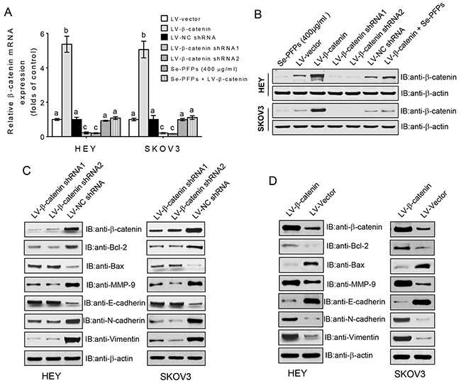 &#x03B2;-catenin signaling regulates the expression of apoptosis- and EMT-related genes.