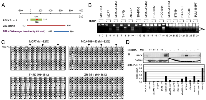 RECK methylation and expression in breast cancer cell lines.