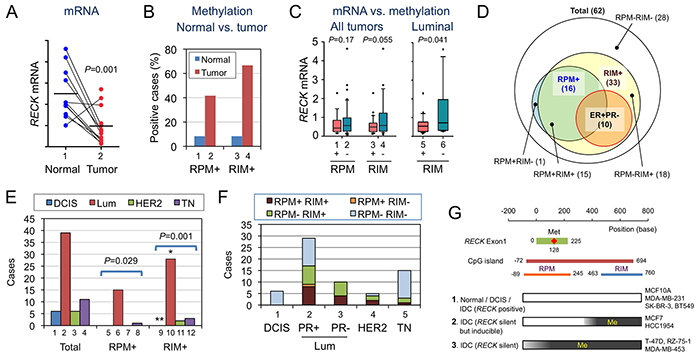 Statuses of RECK mRNA, RPM, and RIM in human breast tissues.