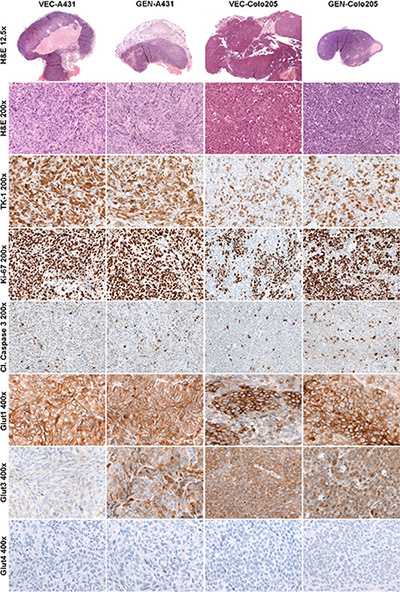 Histologically stained tumor sections of both xenograft models.