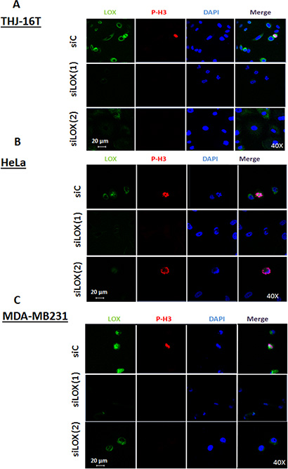 Knockdown of LOX protein using two independents siRNAs.