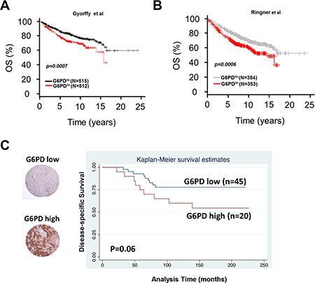 Expression of G6PD in breast cancer patient samples and its correlation with outcome.