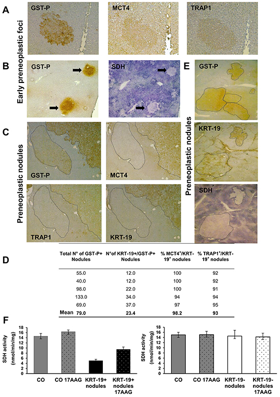 Induction of MCT4 and TRAP1 and inhibition of SDH in Early Preneoplastic Foci (EPF) and preneoplastic nodules.