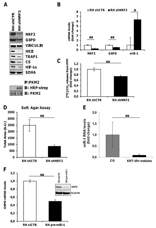 NRF2 modulates G6PD and miR-1 expression.