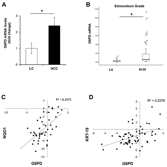 G6PD is up-regulated in human resected HCCs and correlates with NQO1 and KRT-19 mRNA levels.