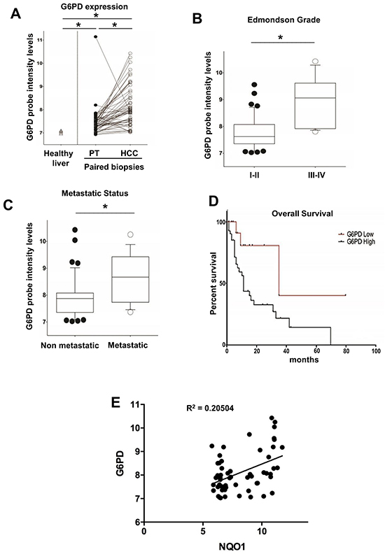G6PD is up-regulated in biopsies from human HCCs and correlates with metastatic status, poor prognosis and NQO1 mRNA levels.