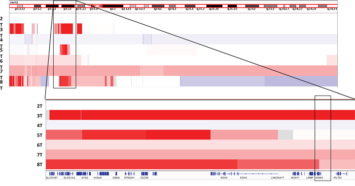 View of recurrent chromosome 12p copy number gains in our sample cohort viewed using Integrated Genome Viewer (IGV)[11].