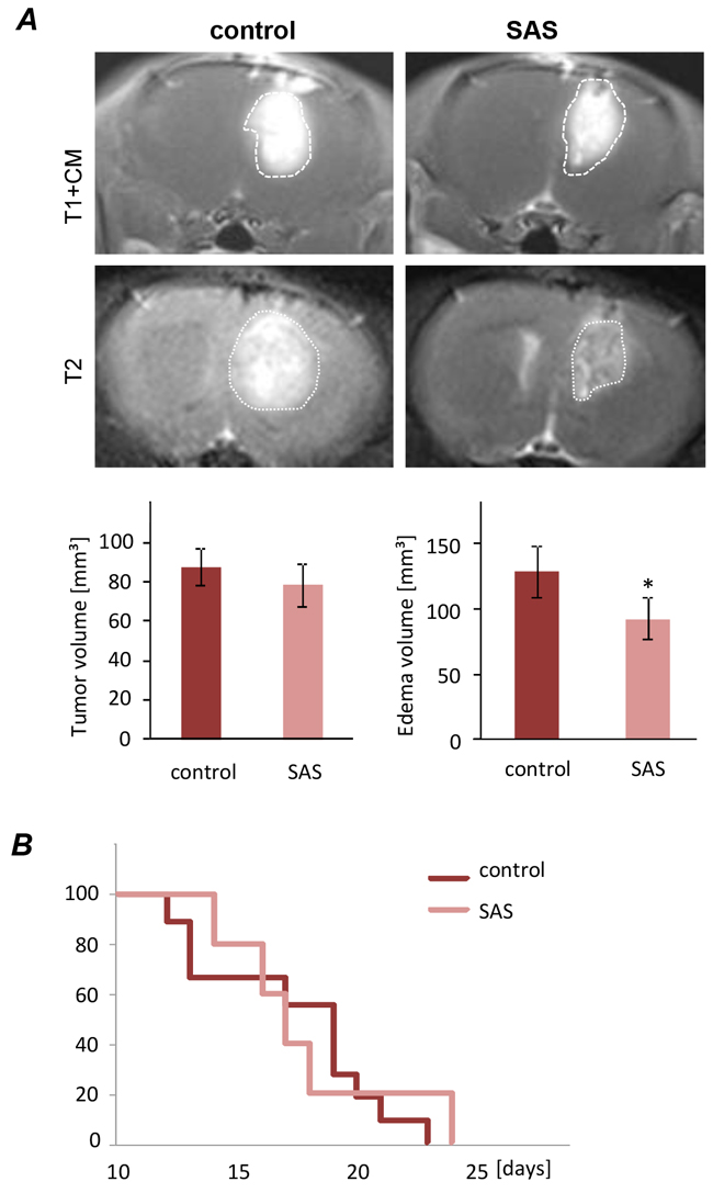 Sulfasalazine treatment alleviates tumor-induced peritumoral edema in vivo.