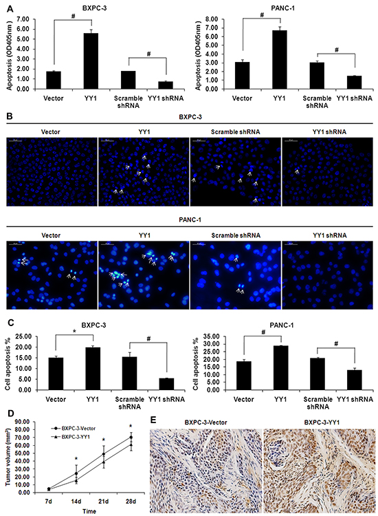 YY1 overexpression induces apoptosis in pancreatic cancer cells in vitro and in vivo.
