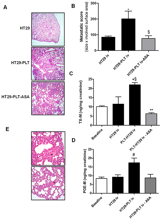 The administration of low-dose aspirin constrains enhanced metastatic potential of mesenchymal-like cancer cells induced by platelets.