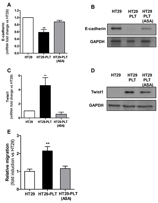 Platelets induce EMT in HT29 cells through an aspirin-sensitive mechanism.
