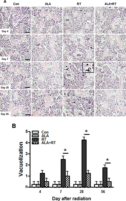 ALA decreases pathological changes in the salivary gland after irradiation.