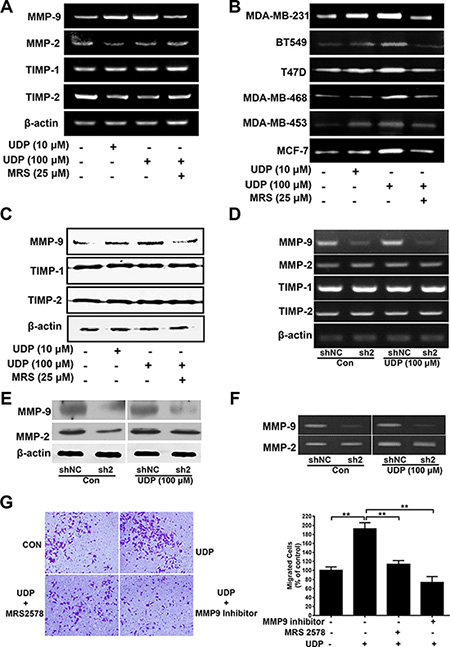 UDP/P2Y6 increases MMP-9 expression in breast cancer cells.