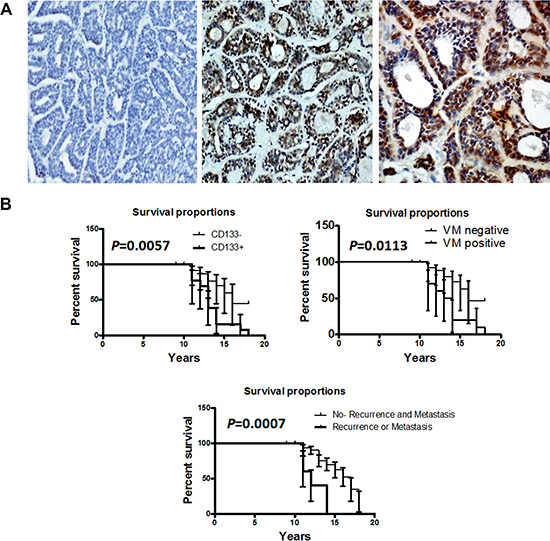 CD133 expression was associated with the prognosis of human ACC patients.