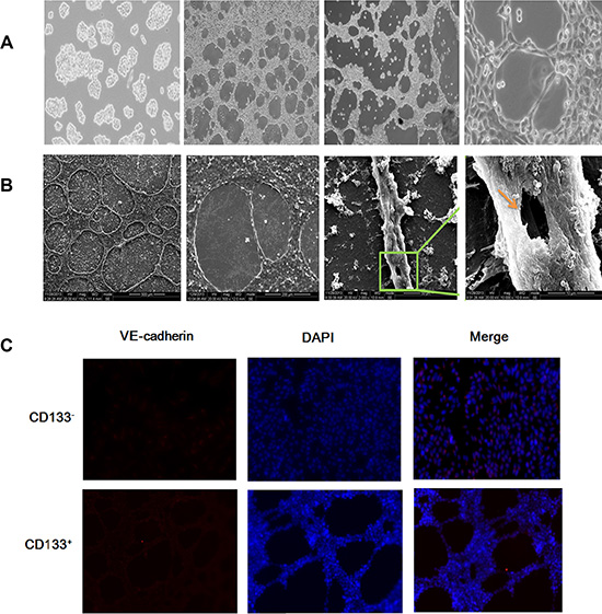 CD133+ cancer stem-like cells promoted VM formation in ACC.