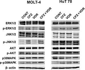 MAPK signaling pathways are mediated by combination treatment of carfilzomib and vorinostat.