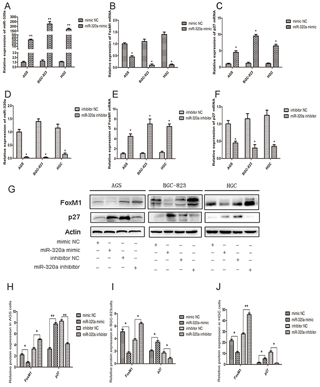 The effect of miR-320a on FoxM1 and P27KIP1 expression in human gastric cancer cells.