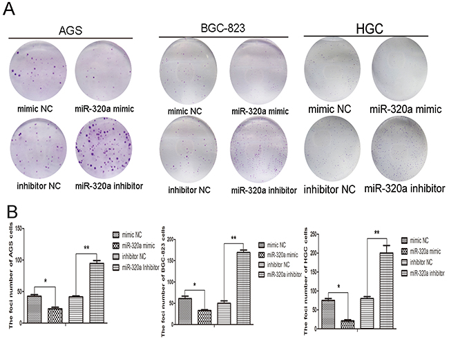 miR-320a was involved in gastric cells proliferation.
