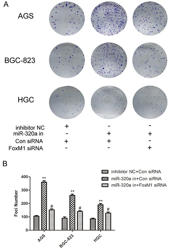 The recovery experiment for miR-320a of colon genetics.