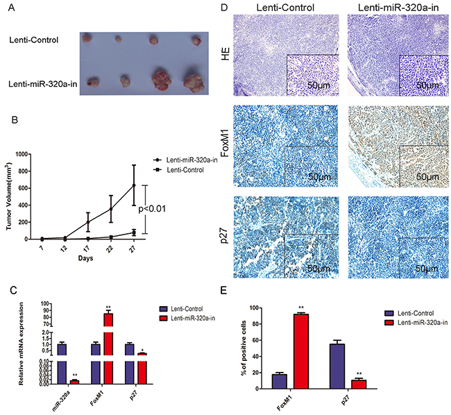 Overexpression of FoxM1 and inhibition of P27KIP1 by miR-320a knockdown in nude mice.