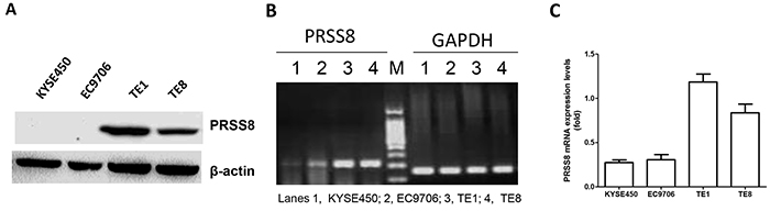 Differential expression of PRSS8 in esophageal cancer cell lines.