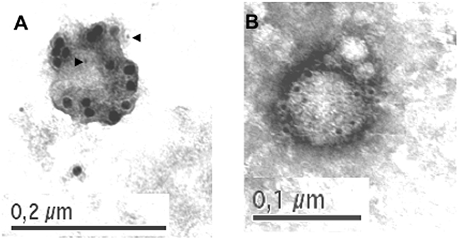 Localization of FasL and Apo2L/TRAIL in exosomes derived from human T cell blasts.