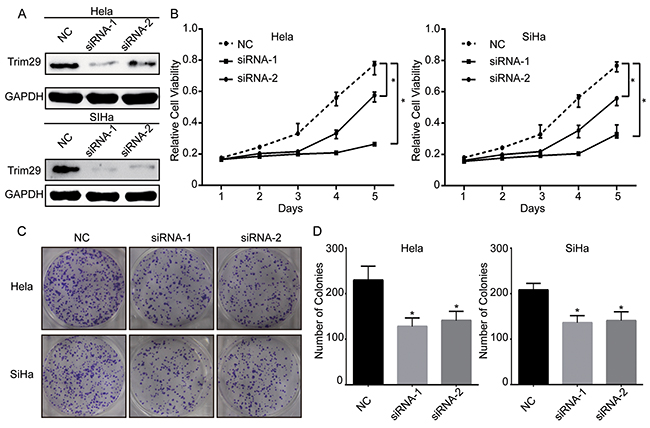 Knockdown of TRIM29 expression suppresses the viability of cervical cancer cells.