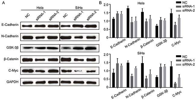 TRIM29 knockdown inhibits EMT and inactivates Wnt/&#x03B2;-Catenin pathway in cervical cancer cells.