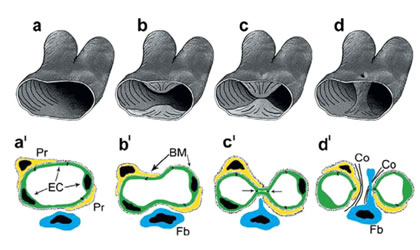 3D (a-d) and 2D (a&#x2019;-d&#x2019;) scheme depicting the generation of transluminar pillar by IMG.