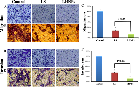 Effects of LS and LHNPs on cell migration and invasion in vitro.