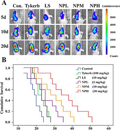 Anti-tumor and anti-metastasis effects of different treatments in 4T1 brain metastatic models.