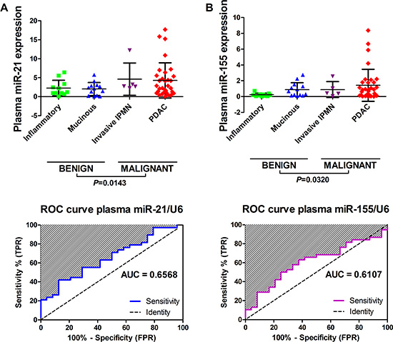 Performance of miR-21 and miR-155 for detecting pancreatic malignancy in plasma samples.