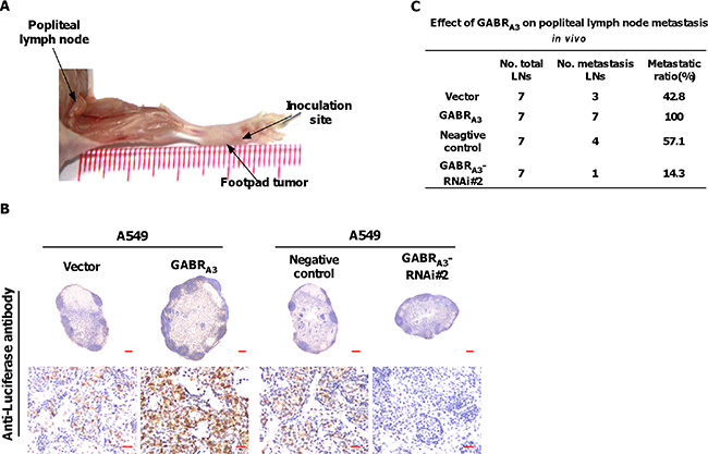 GABRA3 promotes lymph node metastasis in vivo.