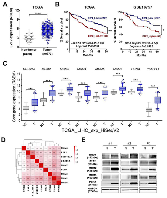 BRD4-E2F2-cell cycle regulation circuit is highly activated in human HCC tissues and high E2F2 expression is associated with poor prognosis of HCC patients.