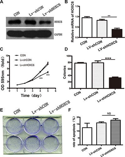 HOXC6 downregulation inhibited tumor cell proliferation in vitro.