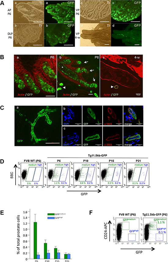 s-SHIP/GFP is transiently expressed in epithelial ducts during postnatal prostate development.