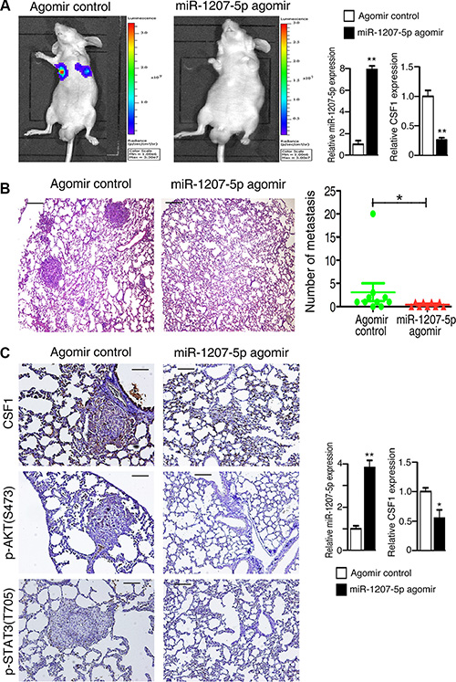miR-1207-5p suppresses the metastasis of A549 cells in a nude mouse xenograft model.