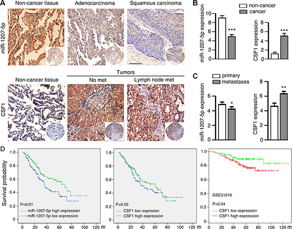 Expression of miR-1207-5p and CSF1 in NSCLC and control non-cancerous lung tissues by means of TMA.