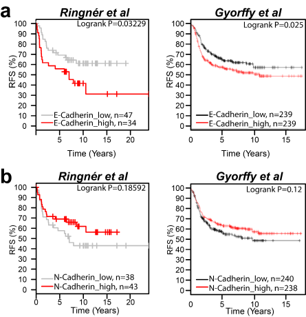 E-Cadherin but not N-Cadherin expression correlates to a poor clinical outcome in patients with breast cancer.